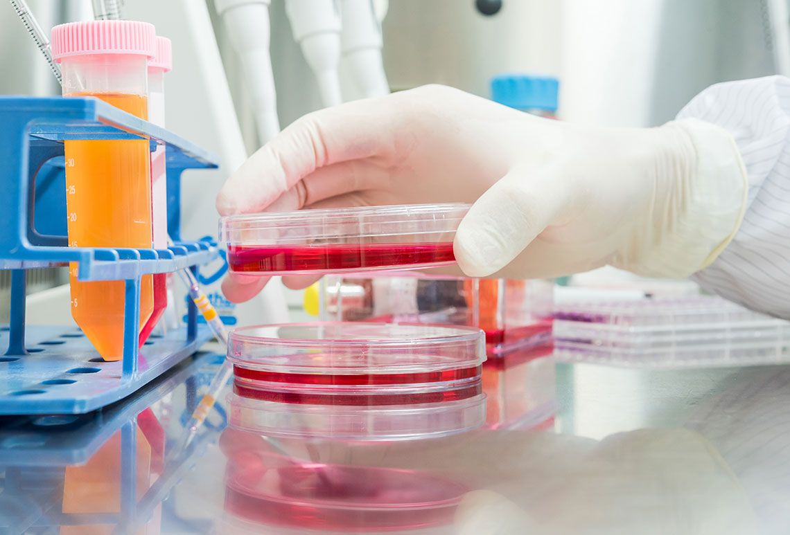 A lab technician's glove hand holding a petri dish