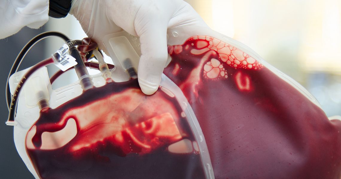 a gloved hand holding a bag of blood